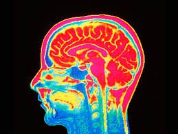 Brain scan from a neuroimaging study